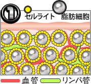 キャビテーション図解