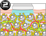 キャビテーション図解