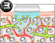 キャビテーション図解
